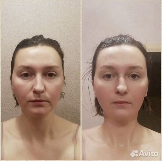 Скульптурно-моделирующий массаж лица