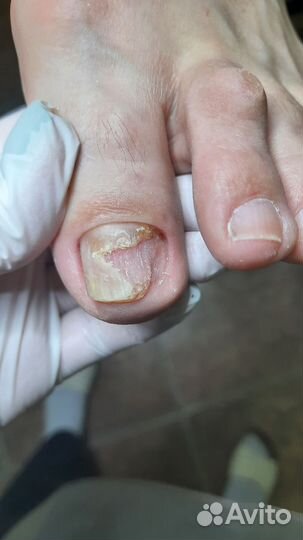 Мужской педикюр