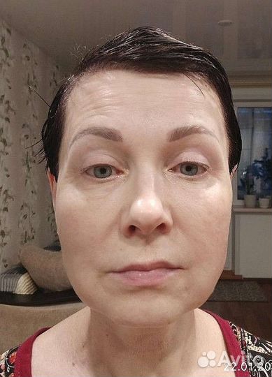 Лифтинг молодости 