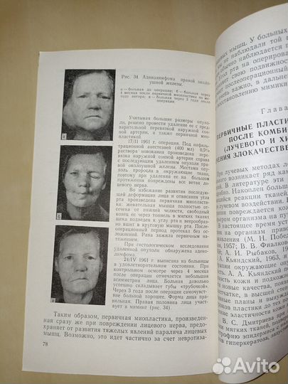 Первичные восстановительные операции при лечении о