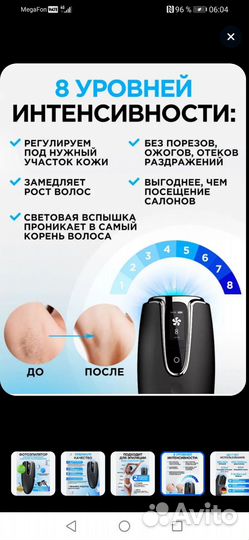 Фотоэпилятор (Германия)