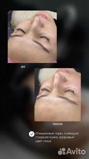 Косметология лица