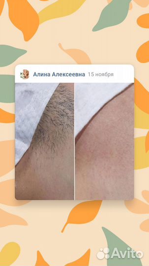 Восковая депиляция