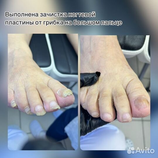 Подология/ Педикюр