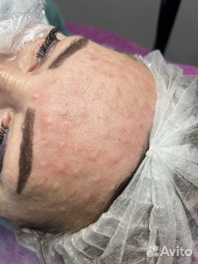 Косметолог иньекцыонист