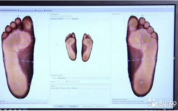 Индивидуальные ортопедические стельки, Оренбург
