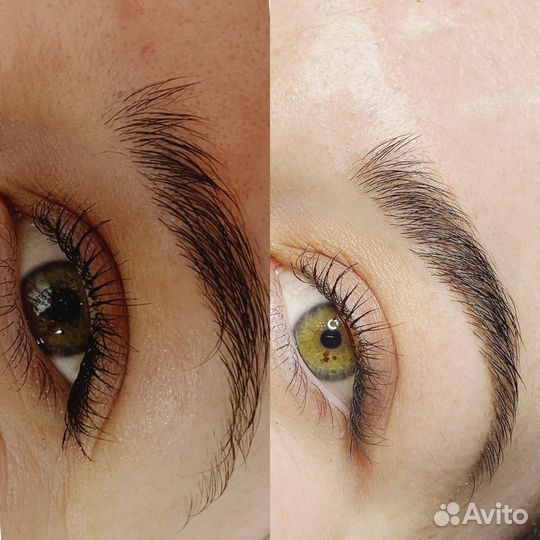 Бровист Броволог