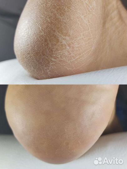 Мастер педикюра, маникюра