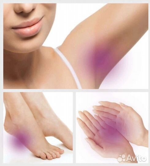 Ботулинотерапия. Лечение гипергидроза