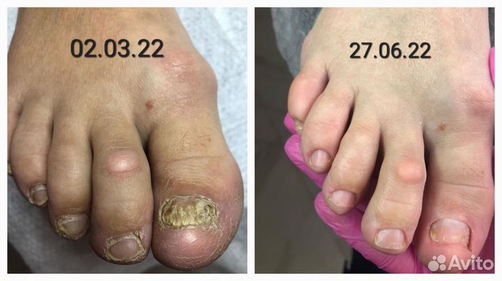 Подолог, педикюр, маникюр