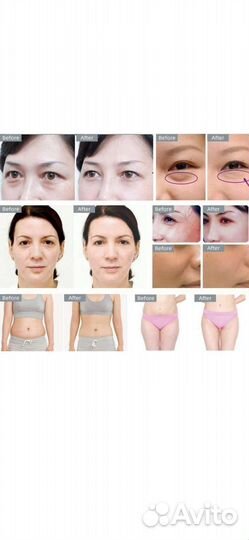 Аппарат для похудения RF лифтинг кавитация