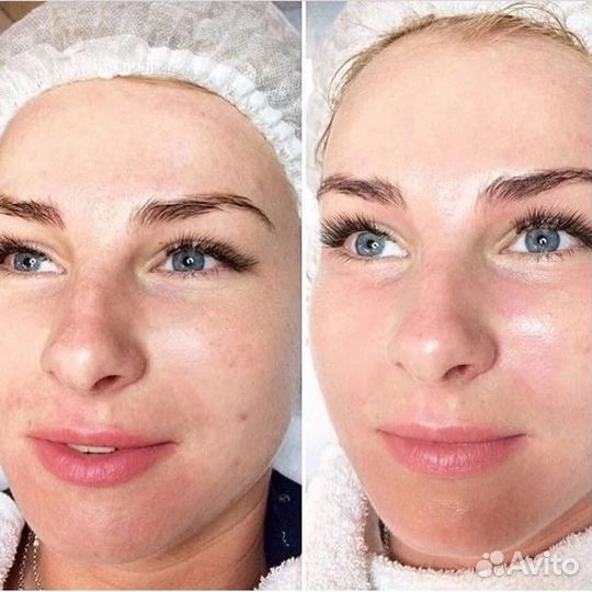 Коррекция фигуры - массаж лица и тела