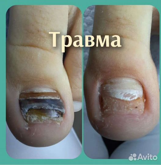 Услуги подолога