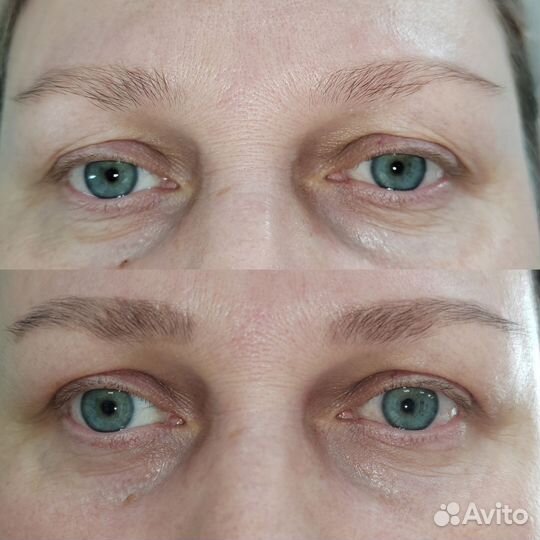 Холодная плазма