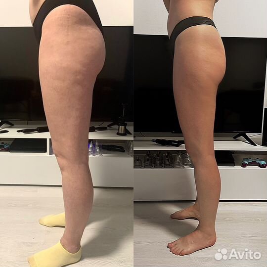 Массаж, коррекция фигуры