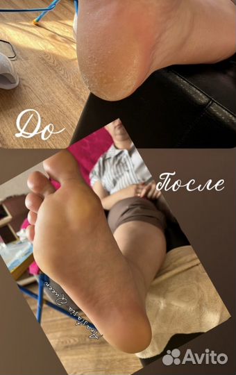 Педикюр на дому