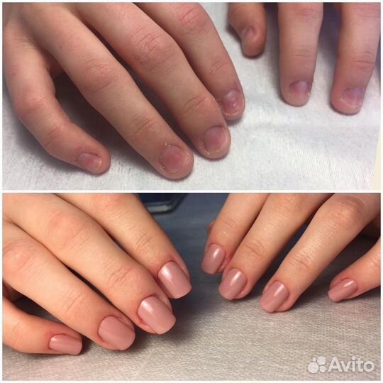 Наращивание ногтей