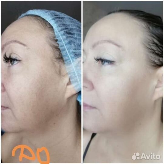 Массаж ручной и аппаратный у мастера