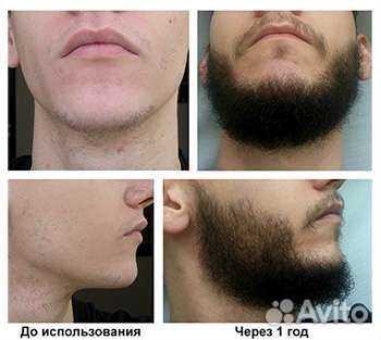 Миниоксидил для роста волос бороды Minoxidil Kirk