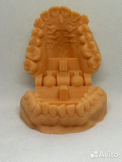 Ортодонтическая 3-D печать