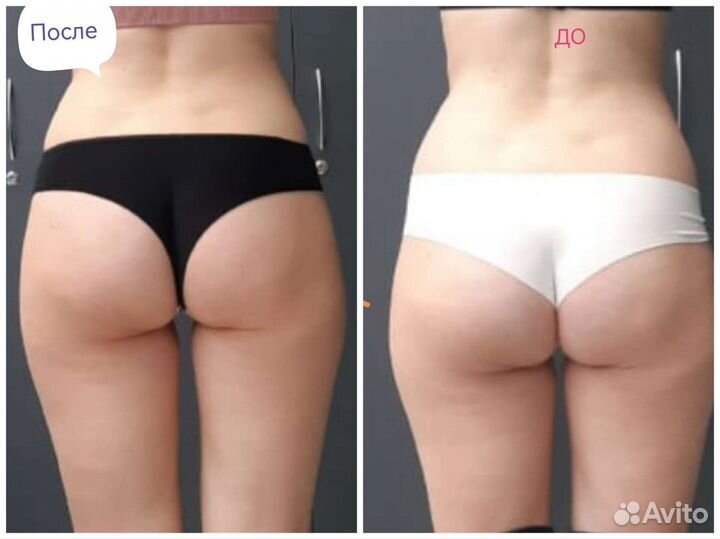 Ручной и аппаратный массаж