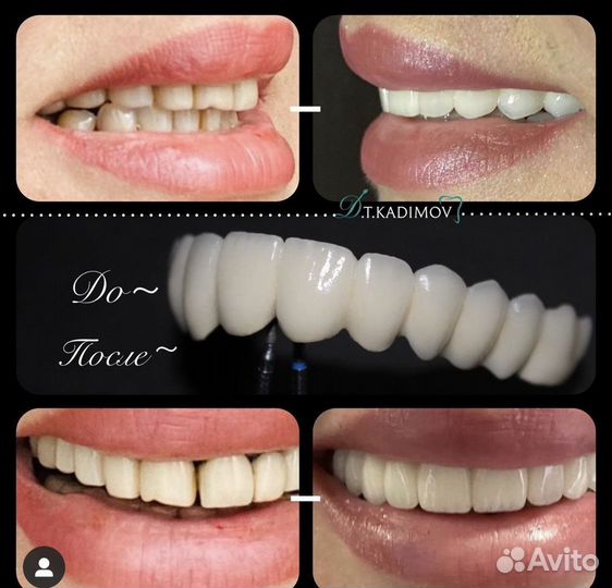 Зубной техник керамист