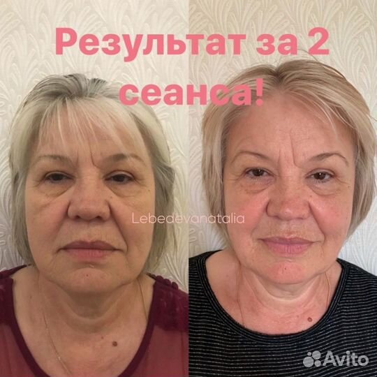 Массаж лица
