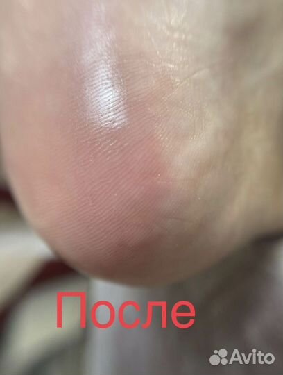 Инновационный Smart-педикюр