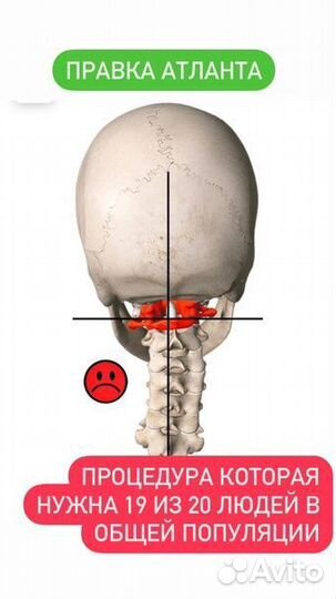 Правка Атланта