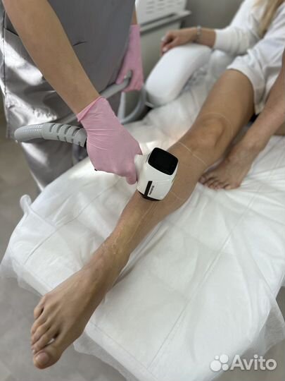 Лазерная эпиляция: бакенбарды