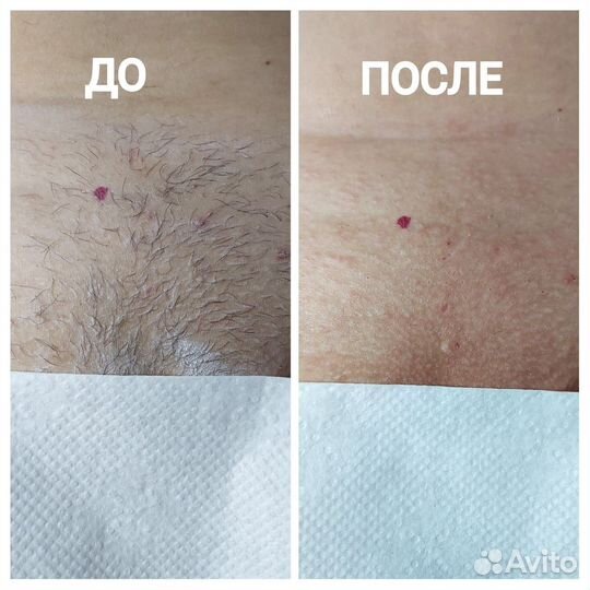 Спа-депиляция (сахар,воск), Кривко, Сосново