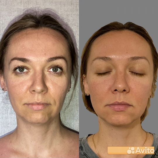 Скульптурный глубокотканный массаж лица