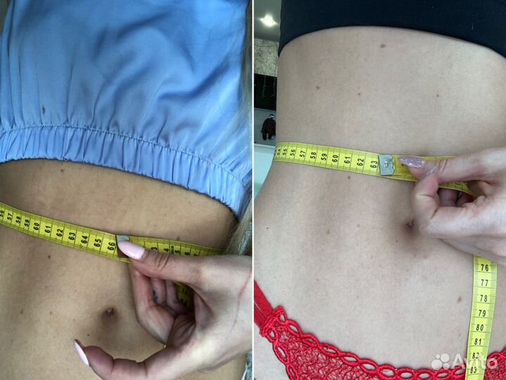 Ручная липосакция