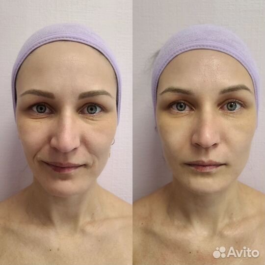 Массаж лица