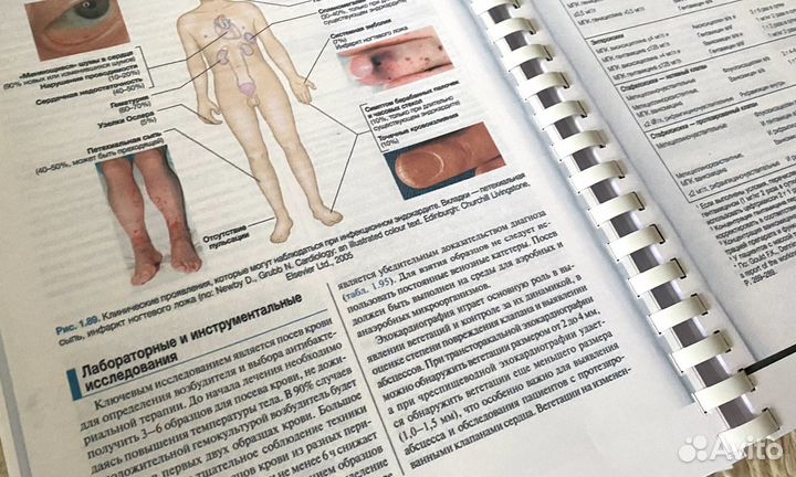 Внутренние болезни по дэвидсону 1 том