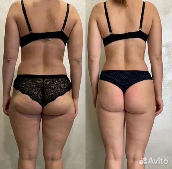 Массаж.Лпдж массаж.вибромассаж.Лпдж массаж лица