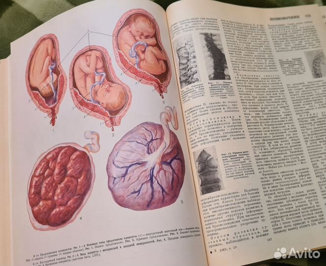Большая медицинская энциклопедия 16, 19, 20 тома