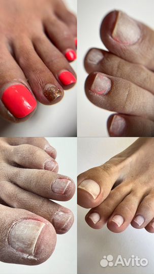 Мастер педикюра на Калинина