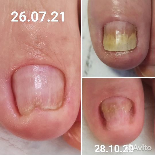 Подолог, педикюр, маникюр