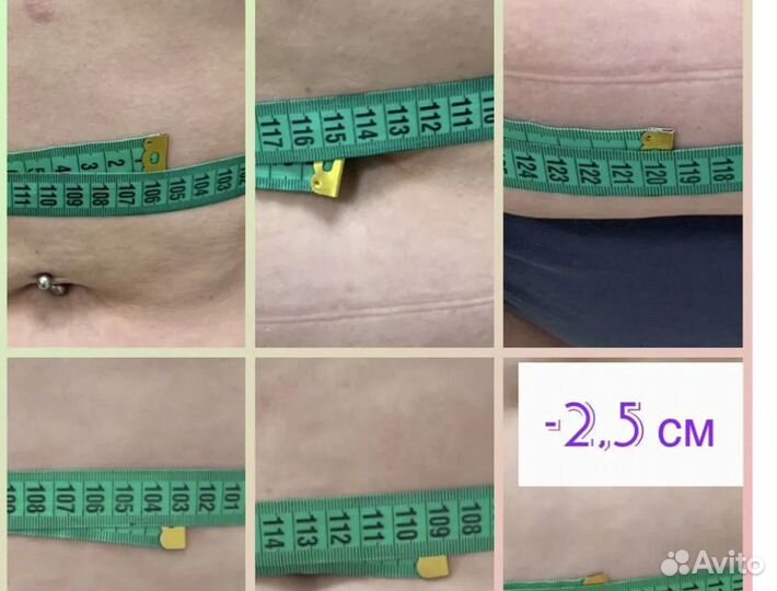 Похудение для мужчин и женщин Криолиполиз Москва