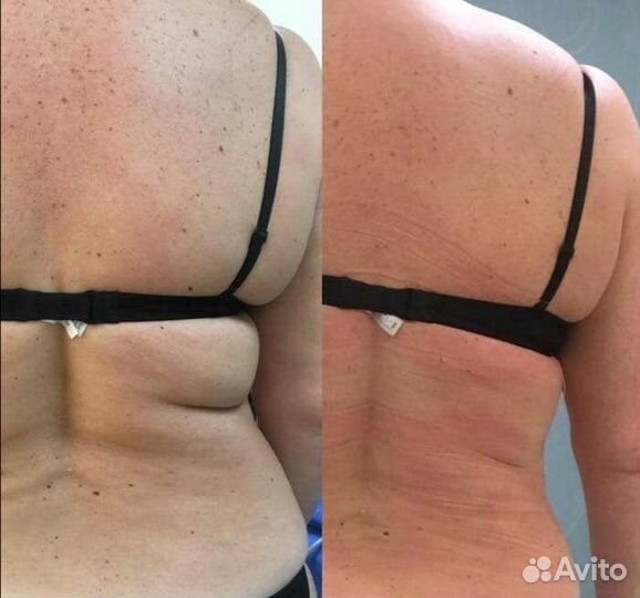 Коррекция фигуры - массаж лица и тела