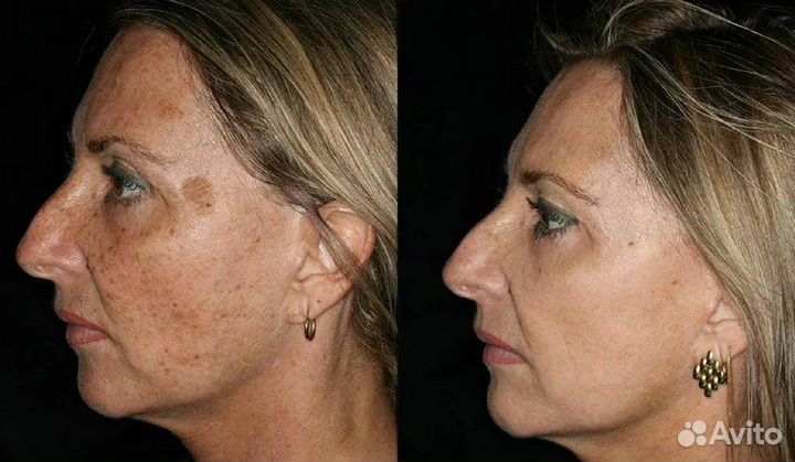 Фотодинамика