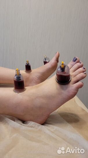 Массаж баночный, вакуумный, оздоровительный