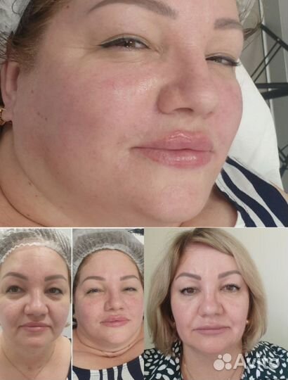 Худое тело, лицо