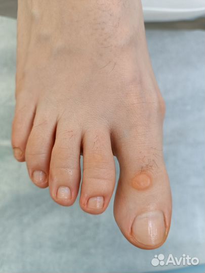 Подологический педикюр