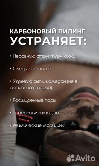 Карбоновый пилинг