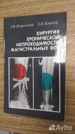 Пособие по хирургии вен