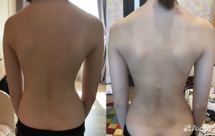 Лечебный массаж скэнар терапия выезд на дом