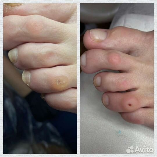 Маникюр и педикюр