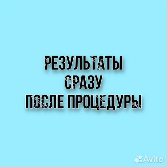 Электроэпиляция: голени